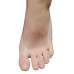 Корректор пальцев GB-15 FootCare